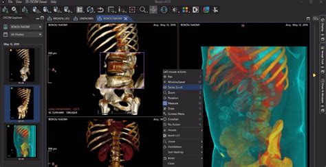 waises|Weasis DICOM medical viewer :: Weasis Documentation.